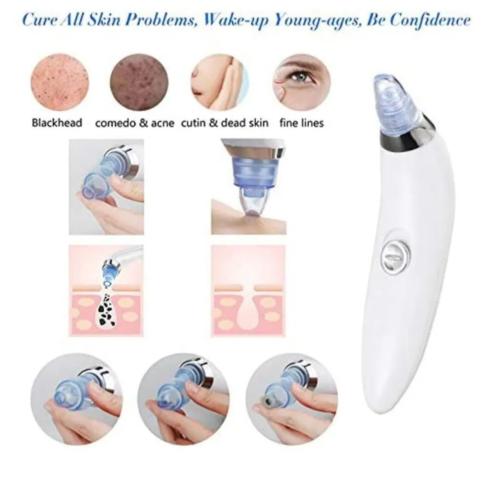 Derma Suction