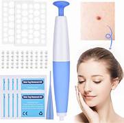 Skin Tag Remover Kit