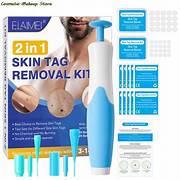 Skin Tag Remover Kit